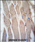 GREMLIN Antibody (C-term)